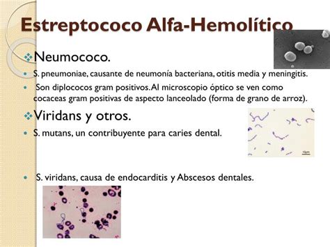 estreptococo alfa hemolítico